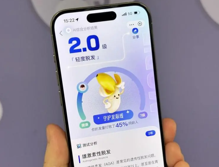 支付宝程序员研发AI毛发自测工具 可自测脱发程度